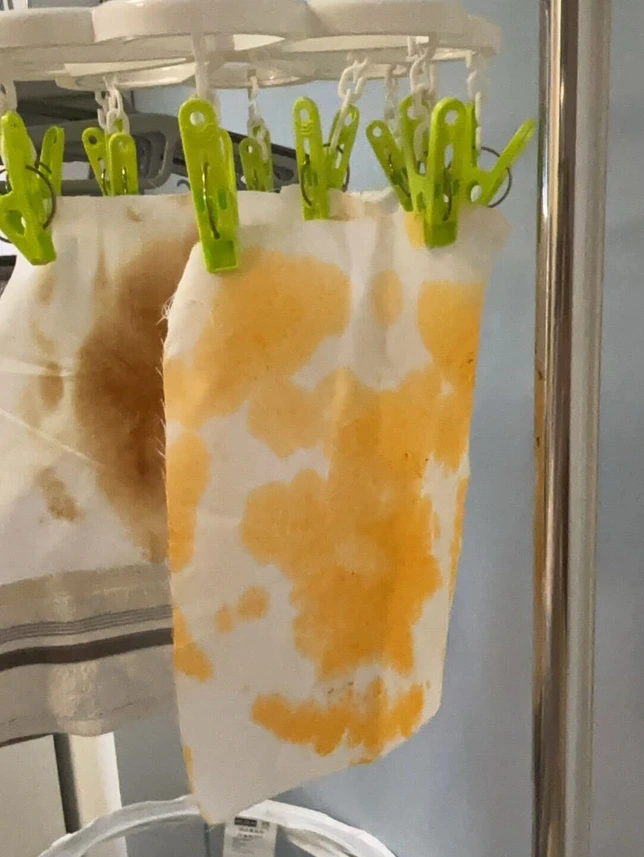 Fabric swatches drying — tie-dye experiment